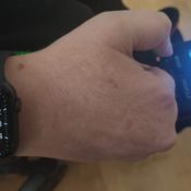 Apple Watch accessibility
